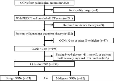 Maximum Standardized Uptake Value of 18F-deoxyglucose PET Imaging Increases the Effectiveness of CT Radiomics in Differentiating Benign and Malignant Pulmonary Ground-Glass Nodules